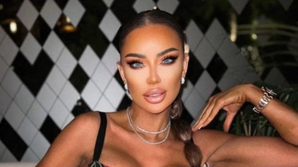 Bianca Drăgușanu și-a făcut o nouă operație estetică la față. Cât costă procedura chirurgicală care e gata în 30 de minute: „Va fi wow”