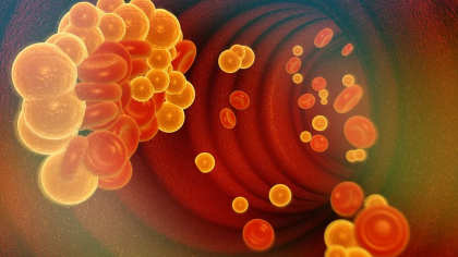 Terapia genetică VERVE-102 promite reducerea colesterolului „rău”