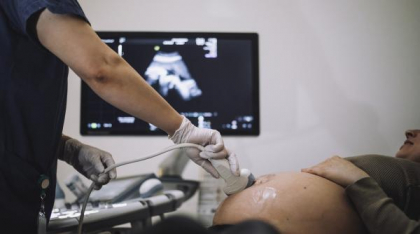 O femeie a rămas însărcinată cu ajutorul inteligenței artificiale. Ce este metoda Star