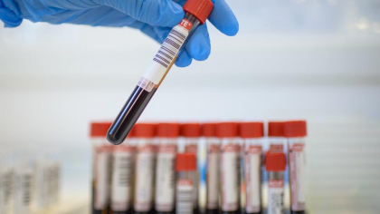 Analize gratuite pentru această categorie de români. Este nevoie doar de trimitere de la medicul de familie