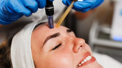 Microneedling: eficiență și rezultate rapide pentru un ten perfect