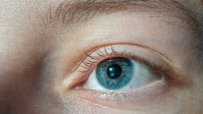 Ochii care nu sunt perfect rotunzi, predispuși la astigmatism