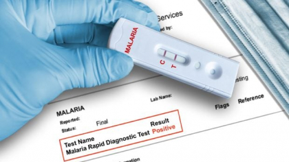 Bărbat din București, diagnosticat cu malarie deși nu a călătorit în străinătate