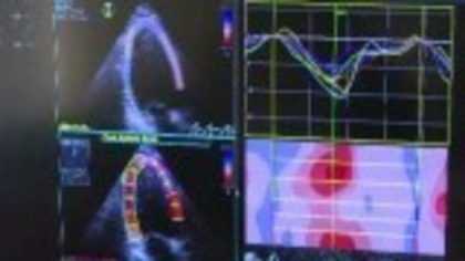 Tot mai mulți bătrâni suferă de „sindromul inimii frânte”. Boala poate duce inclusiv la infarct