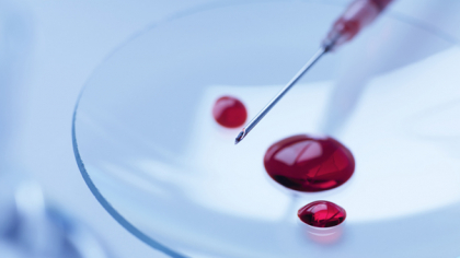 Statele Unite aprobă un nou tratament promițător de prevenire a HIV