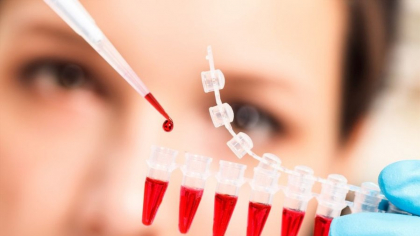 Test revoluționar: o analiză de sânge poate detecta cancerul cu trei ani înainte de apariția simptomelor. „Înseamnă timp pentru intervenție”