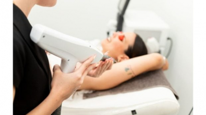 Îndepărtarea tatuajelor: de ce contează calitatea aparatului folosit?