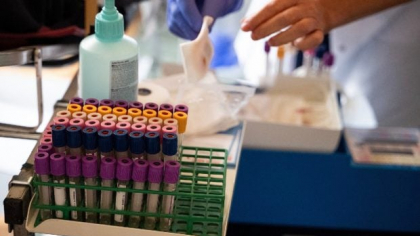 Testul de sânge revoluționar care detectează cancerul cu câțiva ani înainte ca simptomele să apară