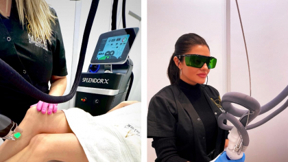 Epilarea definitivă cu laser – Soluția modernă pentru o piele mereu netedă și catifelată