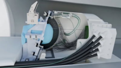 O cască futuristă cu ultrasunete ar putea trata Parkinsonul și depresia fără operație. Cum funcționează dispozitivul