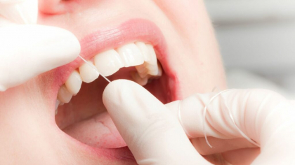 Sănătatea dentară a românilor, tot mai șubredă din cauza scumpirii traiului. Cât costă un implant în 2025