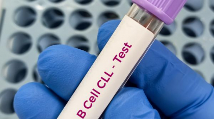 Succes în tratamentul pentru leucemie. Două medicamente au fost mai eficiente decât chimioterapia și au oprit evoluția bolii