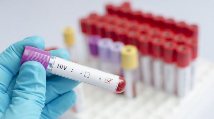 ADN-ul vikingilor a dezvăluit momentul în care a apărut mutația genetică ce combate HIV: acum 9.000 de ani, lângă Marea Neagră