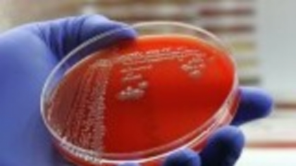 „Fantoma incurabilă”. O genă care face bacteriile rezistente la orice antibiotice se răspândește în spitale din toată lumea