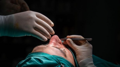 Rinoplastie estetică sau septoplastie? Diferențe și recomandări