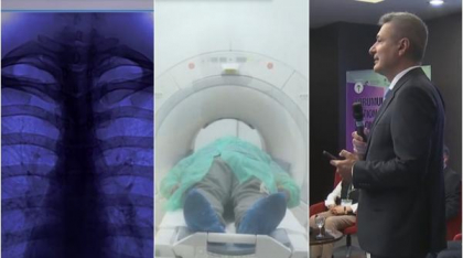 Forumul Național de Gineco-Oncologie: Depistat la timp, cancerul este vindecabil. Câți români au raportat teribila boală în 2024