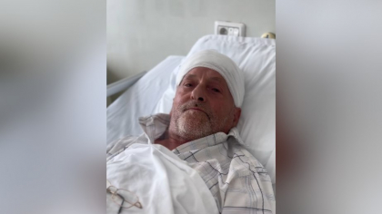 Bărbat de 67 de ani, salvat de medicii din Iași. Acesta s-a prezentat cu o tumoră cerebrală uriașă, de aproximativ 10 cm