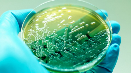 Bacterie periculoasă depistată în apa recoltată de la Spitalul de Pneumoftiziologie Floreşti