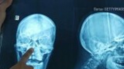 Cum poți să vezi cât va mai crește în înălțime copilul tău. Explicațiile medicilor