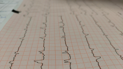 În afara terenului: sedentarismul copiilor și factura cardiovasculară pe care Bucureștiul o va plăti