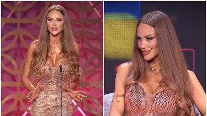 Bianca Drăgușanu, schimbată complet la față. Motivul pentru care are bărbia atât de ascuțită: „Multă lume e deranjată de aspectul meu”