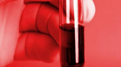 Descoperire uimitoare în medicină. A fost identificată o nouă grupă de sânge