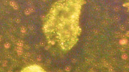 Nanoparticule de aur descoperite în ace de molid. Cum pot influența bacteriile din interiorul plantelor acumularea metalului în copaci