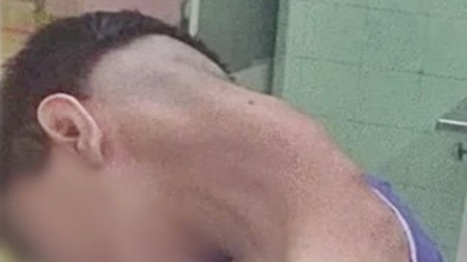 Cum arată terifiantul „sindrom al capului căzut”. Avertismentul medicilor pentru cei care se uită prea mult în telefon