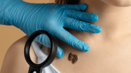 Știai că la Clinica Hereditas Suceava există specializarea Dermato-Venerologie în Rădăuți