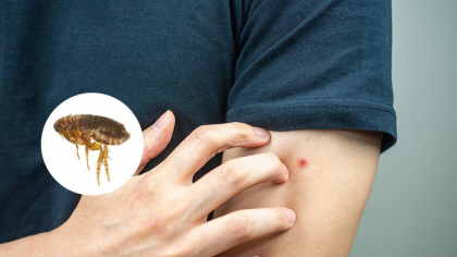 Frunza banală care te scapă pentru totdeauna de purici. E gratis și o găsești peste tot