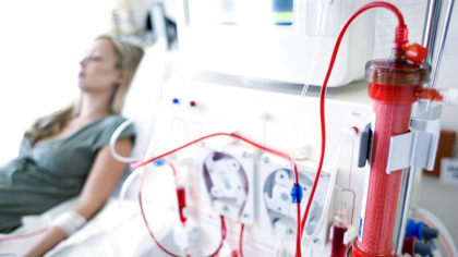 Boala cronică de rinichi: testul simplu, de sub 1 euro, care poate salva rinichii românilor și preveni dializa
