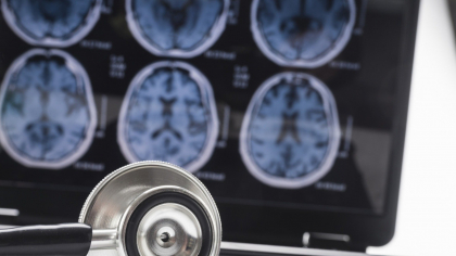 Alzheimer: ADN-ul dezvăluie cine este cel mai expus riscului și cum se va îmbolnăvi