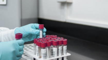 Un simplu test de sânge poate arăta cât de „bătrâne” sunt organele tale. Descoperire revoluționară la Stanford