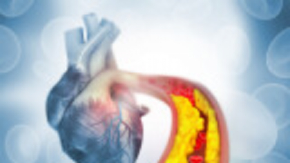 Colesterolul rău și riscul ascuns. Rolul statinelor în prevenirea infarctului