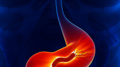 O bacterie din copilărie ar putea cauza 15 milioane de cazuri de cancer