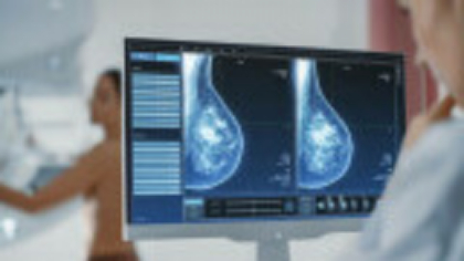 Un nou medicament ar reduce simptomelor femeilor care fac tratament pentru cancerul de sân. Ce arată un studiu