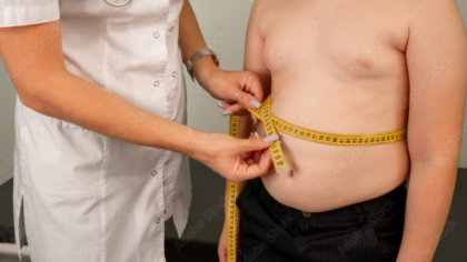Medicii trag un semnal de alarmă: O treime dintre tinerii români sunt obezi