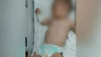 Un copil de un an și jumătate, ars grav după ce a căzut într-o oală cu apă fiartă. Autoritățile au deschis o anchetă