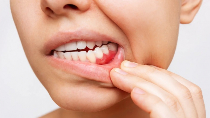 Gingiile care se retrag pot semnala o problemă gravă - nu le ignora. Alte semne ascunse. Cum să-ți salvezi oasele
