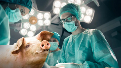 Premieră medicală. Plămân de porc transplantat la om