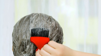 Masca naturală de păr care poate elimina rapid și ușor mătreața. Nu este nevoie decât de câteva ingredeinte simple