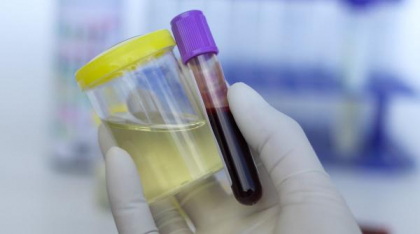Revoluție în sistemul medical: analizele de sânge, direct la medicul de familie