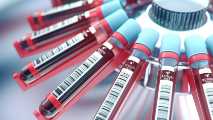 Ziua Mondială de Conștientizare a Hemoglobinuriei Paroxistice Nocturne în România
