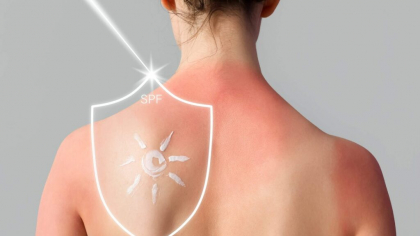 Evită arsurile solare: Cum alegi SPF-ul potrivit? (P)