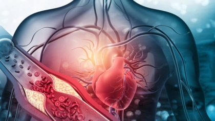 Colesterolul redus într-o săptămână. Cinci pași recomandați de nutriționiști