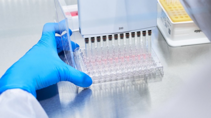 Cinci alimente care distrug celulele canceroase