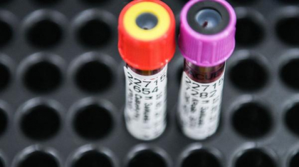 Acest test de sânge „uitat” ar putea depista cancerul mai devreme