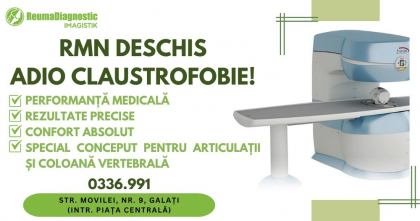 RMN Deschis Dedicat Afecțiunilor Musculo-Scheletale: Precizie și Confort în Diagnosticul Osteo-Articular