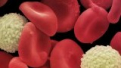 Cele mai importante analize care se fac sub 50 de ani: hemoleucograma și electroforeza proteinelor