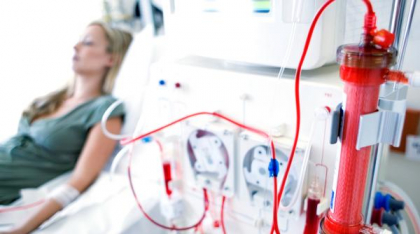 O femeie a început să mănânce spuma sintetică din scaunul pe care stătea, în timp ce făcea dializă. Cum explică medicii cazul unic